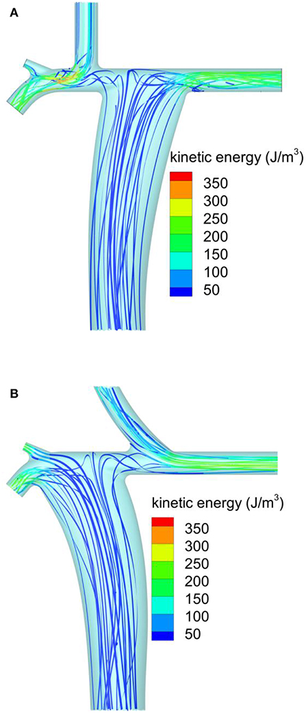 CFD simulations, licence: CC-BY